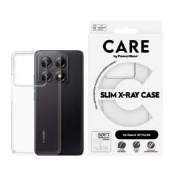 Гръб CARE by PanzerGlass за Xiaomi 14T Pro, Fashion, X-Ray, Прозрачен