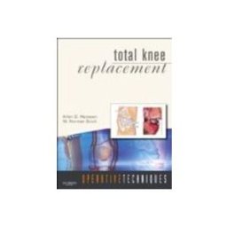 Total Knee Replacement