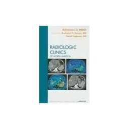 Advances in MDCT