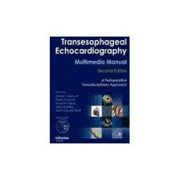 Transesophageal Echocardiography Multimedia Manual