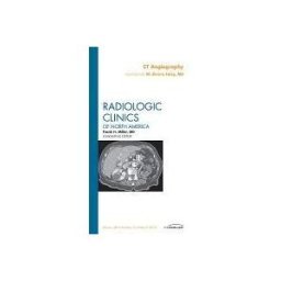 CT Angiography