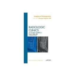 Imaging of Osteoporosis