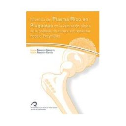 Servicio de Publicaciones y Difusión Científica de la Influencia Del Plasma Rico En Plaquetas En La Valoración Clínica De La Prótesis De Cadera Sin Cementar Modelo