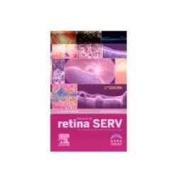 Elsevier España S.l. manual de retina serv 2ª ed.