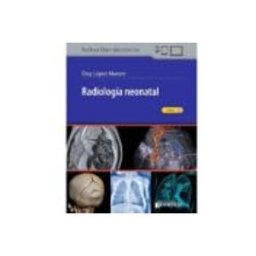 Axon radiología neonatal (incluye libro electrónico)