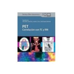 Axon pet correlacion con tc y rm (incluye libro electronico)