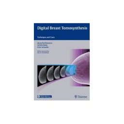 THIEME MEDICAL PUBL INC Digital Breast Tomosynthesis: Technique And Cases