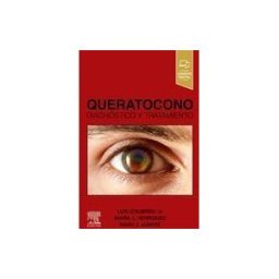 Elsevier España, S.L.U. Queratoconon