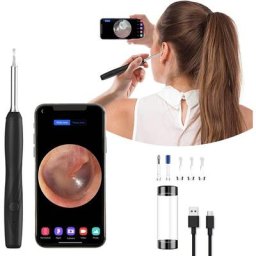 Otoscope Oreille Endoscope Caméra Oreille,dolaso 1600P HD 3.6mm Kit de Nettoyage d'Oreille avec 5