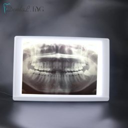 Boîte à lumière d'illuminateur de film radiographique visionneuse de rayons X écran de panneau