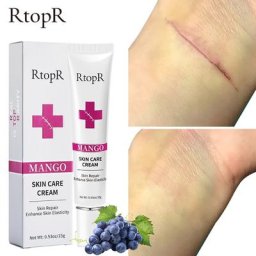 RtopR-Crème Cicatrice Élimine Doucement les Cicatrices Répare la Peau Remplit la Peau Blanchit la