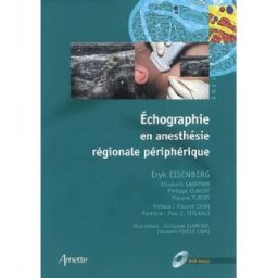 Echographie en anesthésie régionale périphérique eryk eisenberg, elisabeth gaertner, philippe clavert, vincent tubert, collectif Arnette