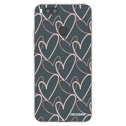 Átlátszó szilikon tok az alábbi mobiltelefonokra Xiaomi Mi A1 Global - Lots of love