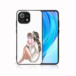 PROTEMIO MY ART Védőburkolat Xiaomi Mi 11 Lite / 11 Lite 5G / 11 Lite NE 5G -BABY GIRL (111)
