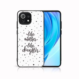 PROTEMIO MY ART Védőburkolat Xiaomi Mi 11 Lite / 11 Lite 5G / 11 Lite NE 5G -LIKE MOTHER (113)