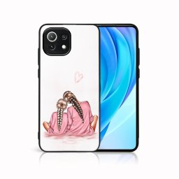 PROTEMIO MY ART Védőburkolat Xiaomi Mi 11 Lite / 11 Lite 5G / 11 Lite NE 5G -DAUGHTER (114)