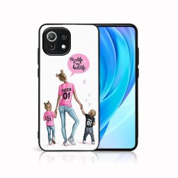 PROTEMIO MY ART Védőburkolat Xiaomi Mi 11 Lite / 11 Lite 5G / 11 Lite NE 5G -MOM (119)