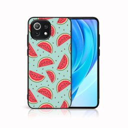 PROTEMIO MY ART Védőburkolat Xiaomi Mi 11 Lite / 11 Lite 5G / 11 Lite NE 5G - GÖRÖGdinnye (120)