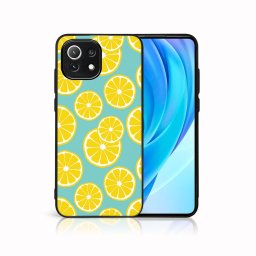 PROTEMIO MY ART Védőburkolat Xiaomi Mi 11 Lite / 11 Lite 5G / 11 Lite NE 5G -LEMON (121)