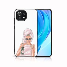 PROTEMIO MY ART Védőburkolat Xiaomi Mi 11 Lite / 11 Lite 5G / 11 Lite NE 5G - CHAMPAGNE (134)