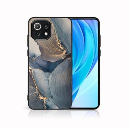 PROTEMIO MY ART Védőburkolat Xiaomi Mi 11 Lite / 11 Lite 5G / 11 Lite NE 5G -SPARKLE (147)