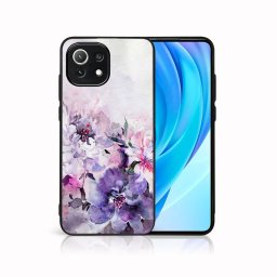 PROTEMIO MY ART Védőburkolat Xiaomi Mi 11 Lite / 11 Lite 5G / 11 Lite NE 5G -PEONIES (156)