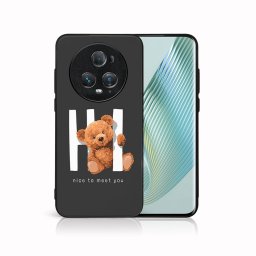 PROTEMIO MY ART Védőburkolat a Honor Magic5-höz Pro 5G HI (182)