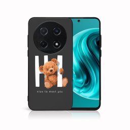 PROTEMIO MY ART Védőburkolat a Huawei Nova 12i-hez HI (182)
