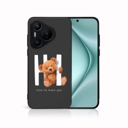 PROTEMIO MY ART Védőburkolat Huawei Pura 70 HI (182)-hoz