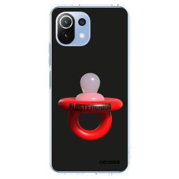 Átlátszó szilikon tok az alábbi mobiltelefonokra Xiaomi Mi 11 Lite - Le Dudel