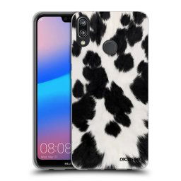 ULTIMATE CASE Huawei P20 Lite - készülékre - Black Moo