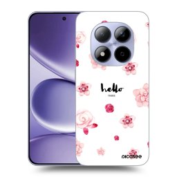 ULTIMATE CASE Xiaomi Redmi Note 15 Pro 4G - készülékre - Hello there