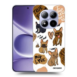 Átlátszó szilikon tok az alábbi mobiltelefonokra Xiaomi Redmi Note 15 Pro 4G - Frenchies