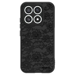 ULTIMATE CASE Xiaomi 17 - készülékre - Dark Elegance