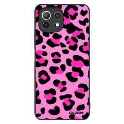 ULTIMATE CASE Xiaomi 11 Lite 5G NE - készülékre - Pink Tiger