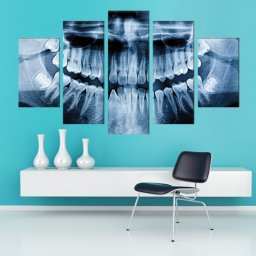 Multicanvas Radiografie Dentara X-RayTH7 (SET 5 TABLOURI CANVAS: 2x25x40cm/ 2x25x60cm/ 1x25x75cm)