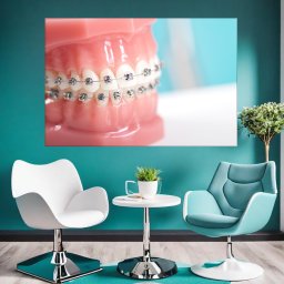 Tablou Canvas Simulare Dinti cu Aparat Dentar TH93 (Dimensiune LxH: 150x100cm)