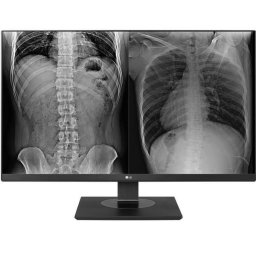 Monitor medical profesional IPS LED LG 27" 27HJ713C-B, UHD (3840 x 2160), HDMI, DisplayPort, Pivot, Negru