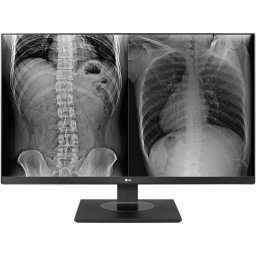 Monitor LED LG 27HJ713C-B 27 inch UHD IPS 5ms 60Hz Black