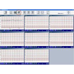 MEDICAL ECONET® CMS - Fetal Central Monitoring system